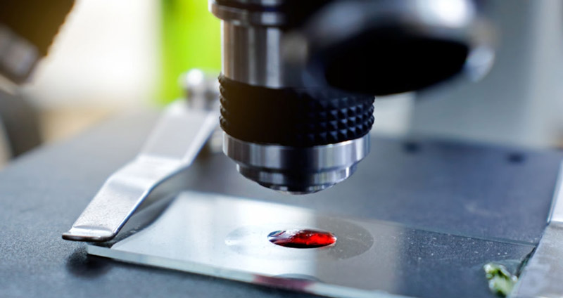 تجزیهوتحلیل نرخ پرش