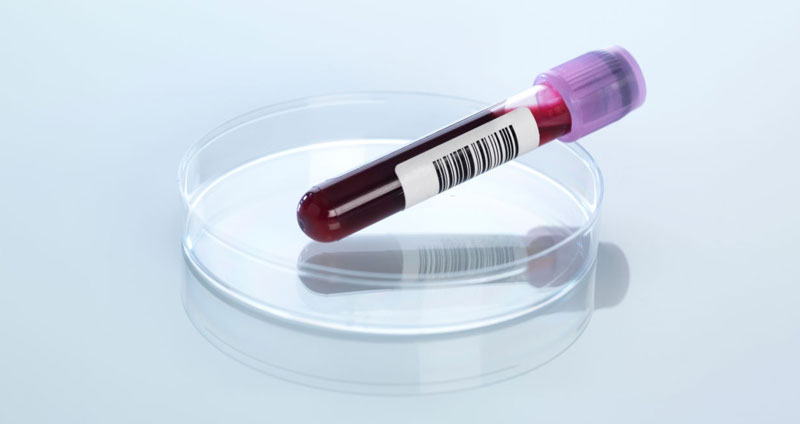 تست شخصیت شناسی بدهید